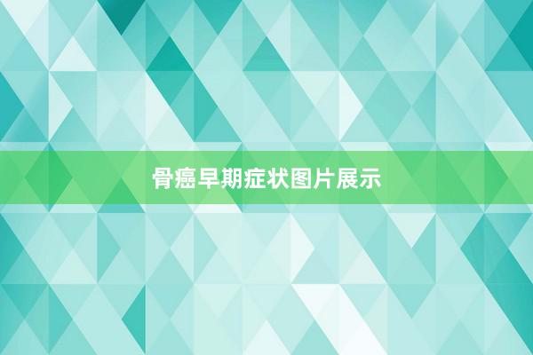 骨癌早期症状图片展示